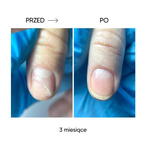 NAILSOFTHEDAY Onistop - regenerating oil against onycholysis, 15 ml