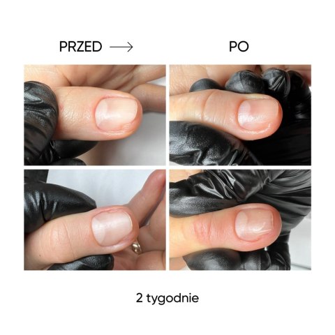 NAILSOFTHEDAY Onistop - regenerating oil against onycholysis, 15 ml