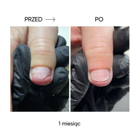 NAILSOFTHEDAY Onistop - regenerating  oil against onycholysis, 15 ml